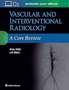 健康・医学 Interventional Neuroradiology Case-Based Interventional Neuroradiology: 9781604063738